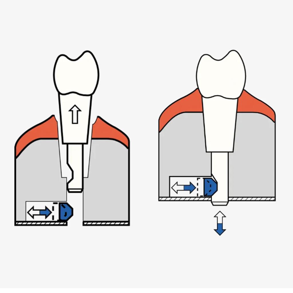 Dental Tooth Model Removable Compatible With KaVo Basic Teeth teeth Retention Mechanism Practice and Teaching