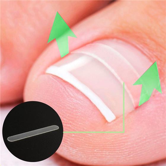 10Pcs Professional Ingrown Toenail Straightening Clip Curved Brace Toenails Correction Tool