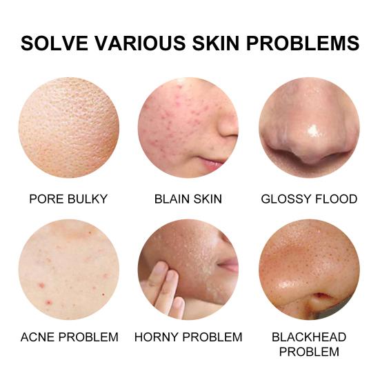 100 г мыло для ухода за лицом, натуральное многофункциональное мыло для удаления грязи с протеином шелка, восстановление кожи для девочек