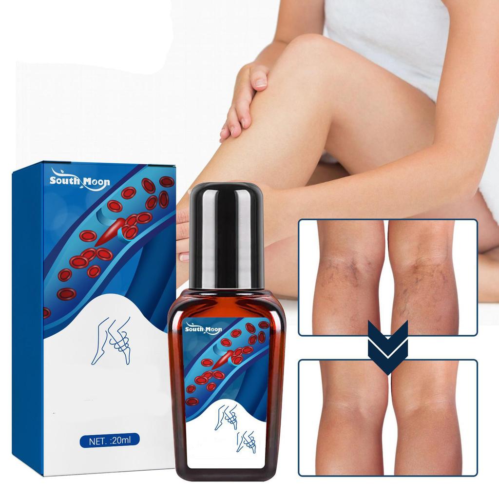 Essential Oils Essential Oils Essential Oils Essential Oils Essential Oils 20ml Pure- Herbal Soothing Spray Ingredient Vein Soothing Spray