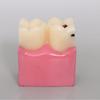 6 раз Модель кариеса зубов Болезнь зубов Стоматологическая модель для демонстрации зубов Модель обучения стоматолога Стоматологическая лаборатория Исследования полости рта