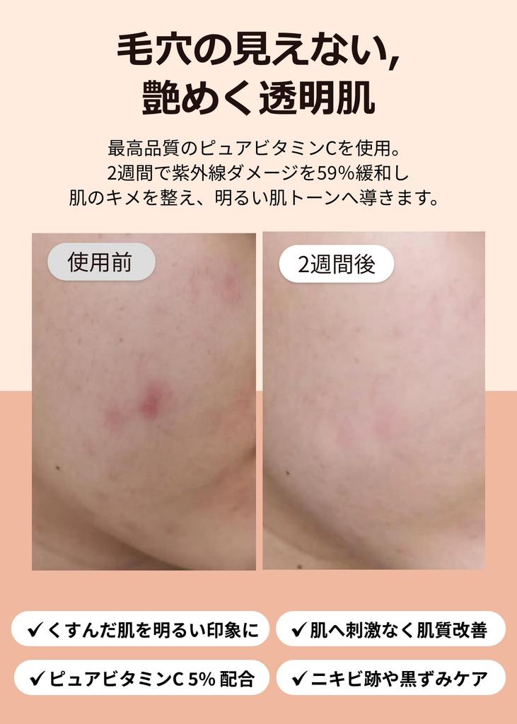 Klairs Freshly Juiced Vitamin Drops 35ml Vitamin C Pure Vitamin Sensitive Warming Ampoule - Serum, C, Anti-Dust, Pore-Cleansing, Exfoliating,