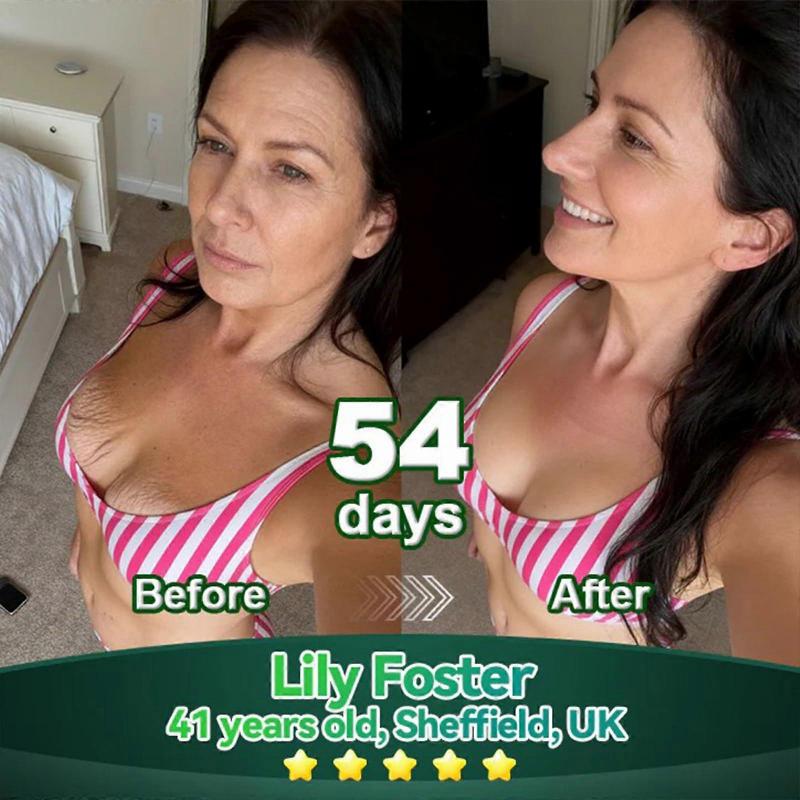 Anti-Wrinkle Stem Cell Collagen Peptide Drops - Hydrolyzed Liquid Collagen for Skin Firming & Wrinkle Reduction