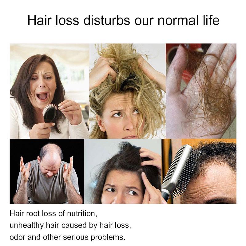 SEVICH 3 шт./компл., 200 мл, шампунь против выпадения волос, имбирь, рост волос, эссенция растений, гель, натуральный шампунь для лечения выпадения волос, уход за волосами