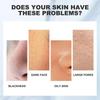 Limited time!!Eelhoe Dead Sea Mud Cleansing Mask Hydrating Deep Cleansing For Skin, Blackhead And Acne Control, Deep Oil Control Mud Mask