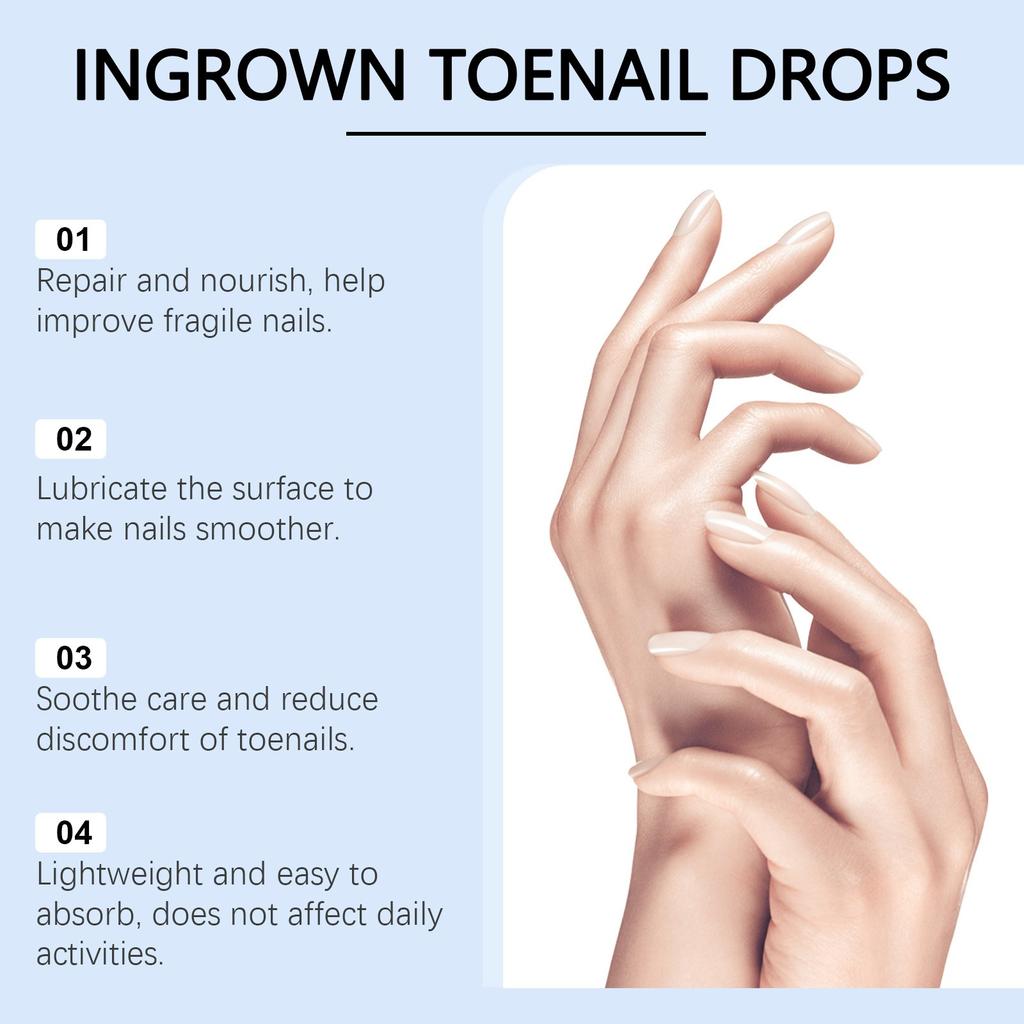 Сыворотка для ухода за ногтями Мягко очищает и осветляет ногти, увлажняет ногти и ногти 30 мл