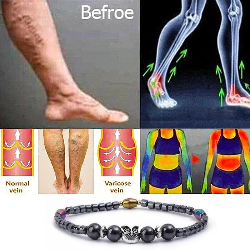 Формованные похудение магнитотерапия здоровье магнит цепи для лодыжки снять усталость потеря веса магнит браслеты для лодыжки натуральные камни браслеты