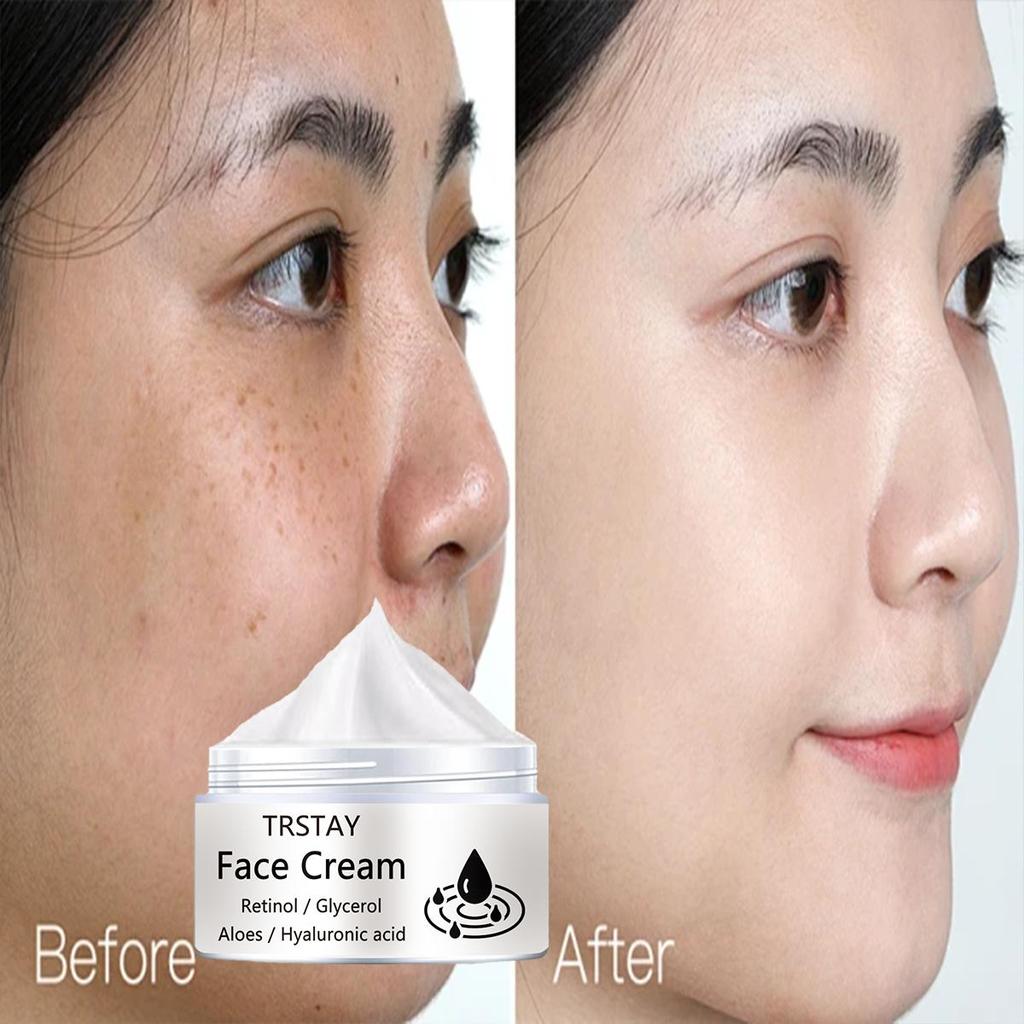 Face Cream Glycerin Aloe Gel, Moisturizing and Brightening Skin, Whitening and Moisturizing, Repairing Damaged Skin Moisturizer