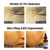 DERMA FACTORY PDRN 4% Ампула 30мл ( 3 варианта)