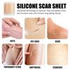 Silicone Scar Sheets Reusable Scar Removal Strips for Post-Surgery Acne Breathable Waterproof Scar Tape
