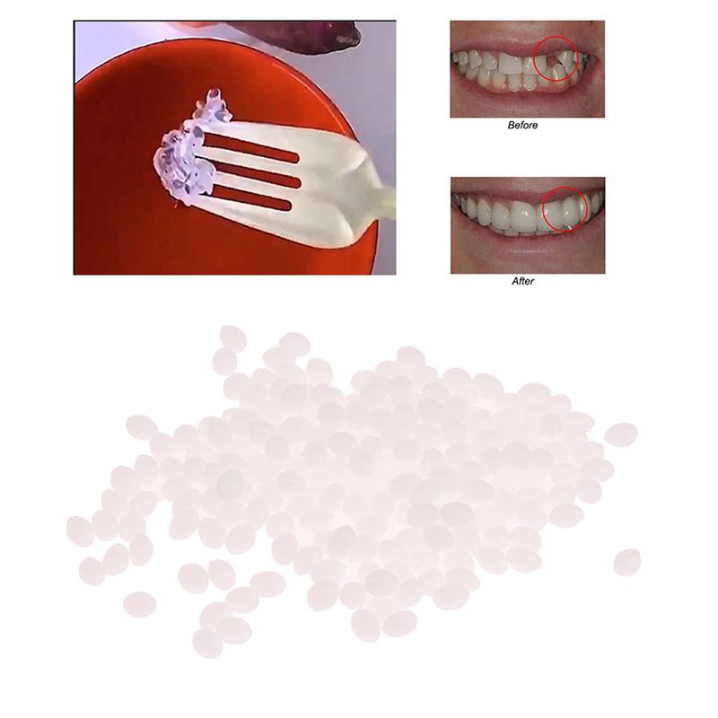 30 мл смоляной клей для восстановления зубов, формирующий зазоры между зубами, твердый временный клей для восстановления зубов, безопасные стоматологические принадлежности