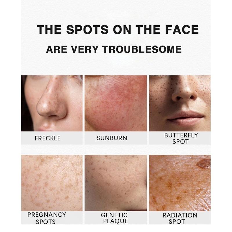 Отбеливающий крем, исчезающие пятна, черные точки, меланин, увлажняющий, осветляющий, мягкий, гладкий, укрепляющий, уход за кожей