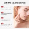 Ximonth Skin Care Patch Gentle Cleansing Face Body Soft Delicate External Use 30 Count