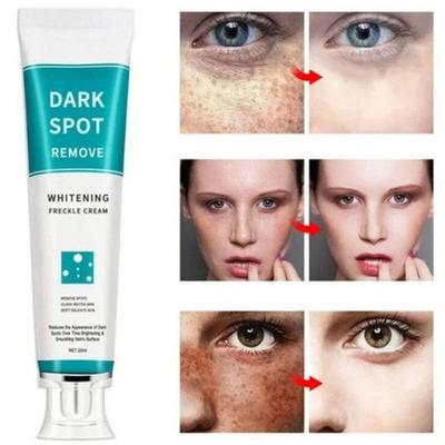 SMIATEY 1+1 Крем для удаления пигментных пятен Vita e Whitening Cream Cream Age Spot Blemishes 20 мл 1 шт., 2 контейнера, 20 г