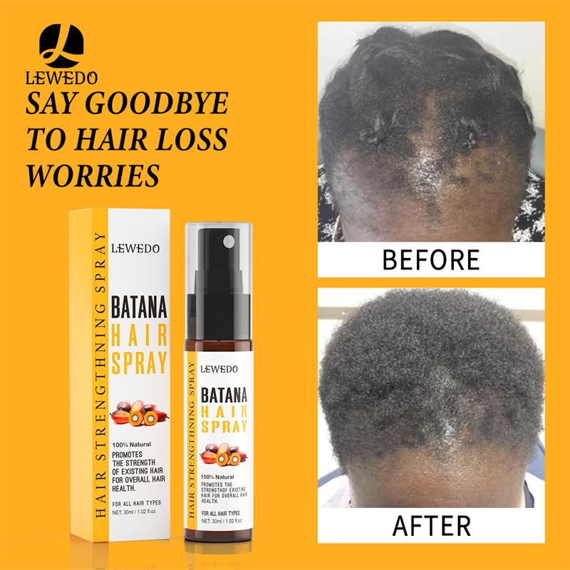 Спрей Батана Глубокое Увлажнение Рост Волос Восстановление Поврежденных Волос Супер Гладкие Африканские От Роста Против Выпадения Волос