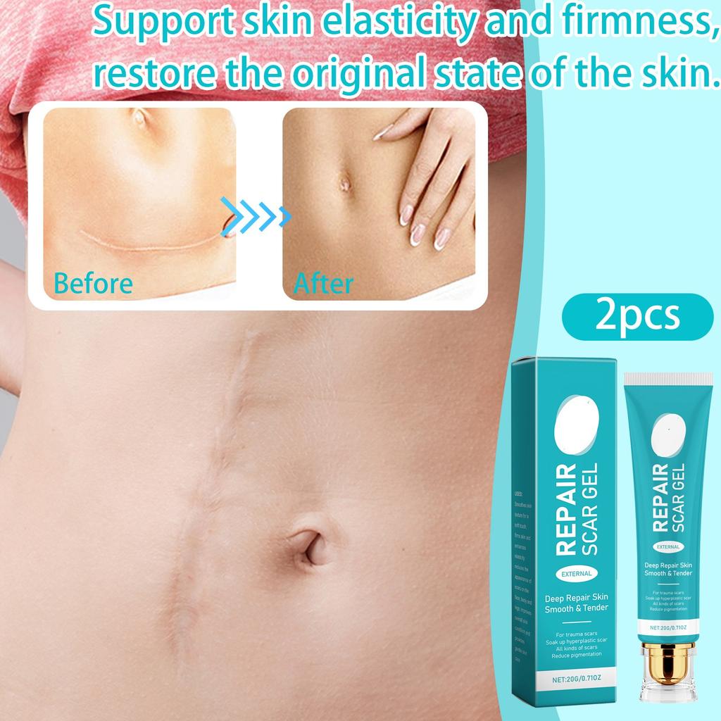 Крем от шрамов, крем для удаления шрамов для мужчин и женщин, разглаживание кожи, укрепление и исчезновение, глубокое разглаживание кожи, нежное внешнее воздействие всех видов