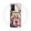 Case - MANIACASE - Redmi Note 11 Pro 5G - Soft - Pitbull Dog - Brown