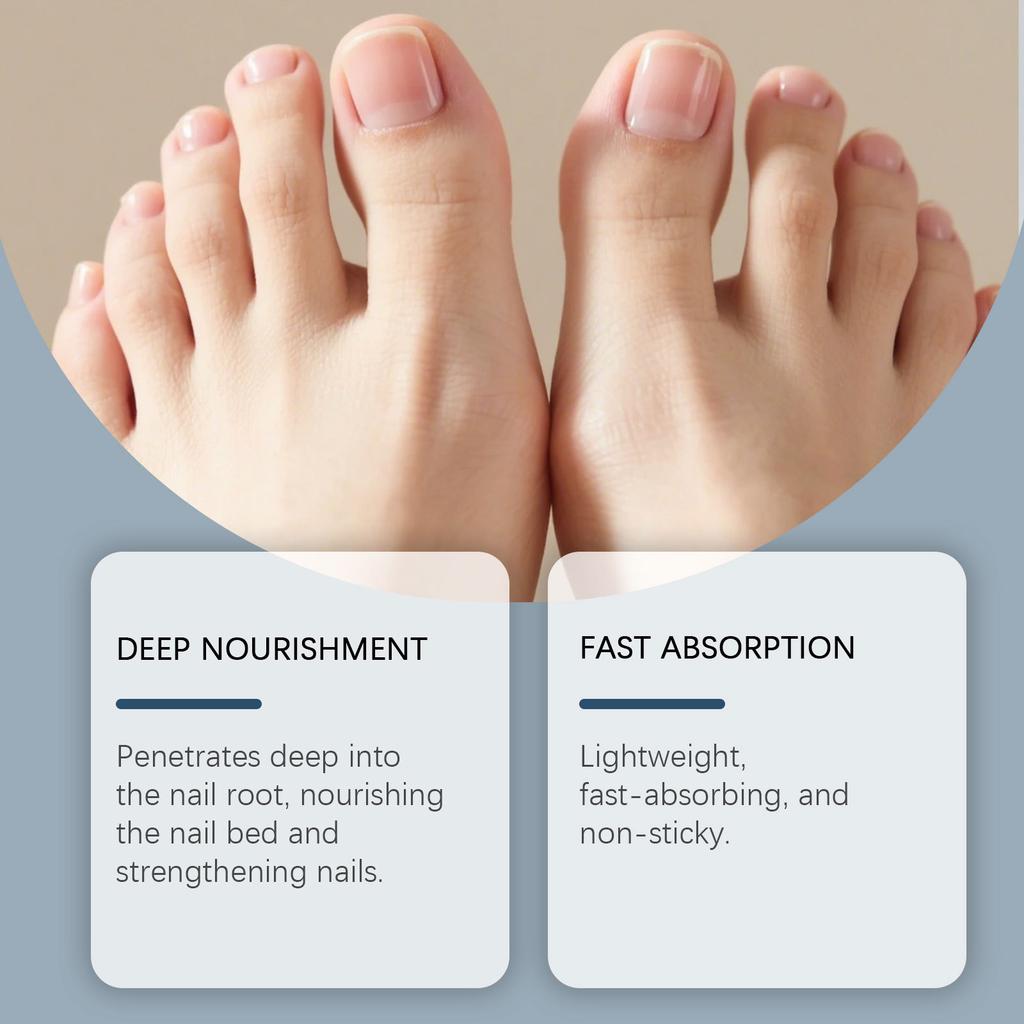 Nail Care Oil  Moisturizing The Fingertips  Nourishing The Nail Surface And Nail Oil 15ml