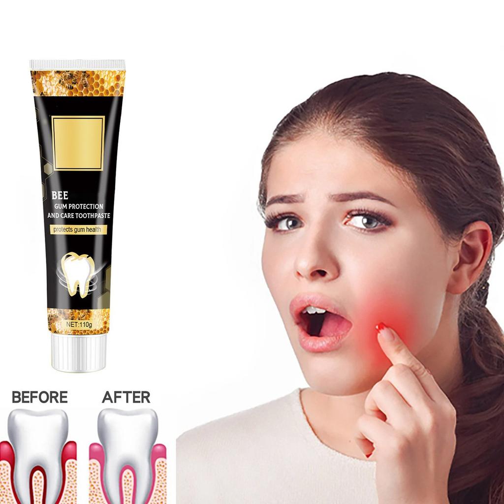 Bee Gingival Toothpaste Deep Clean Tooth Stains Toothicidal Mouthpiece Tooth Stain Removal, Teeth Whitening Booster  110g