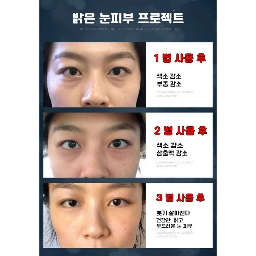 Eye Cream for Under Eye Bags Lifting, Dark Circles, Wrinkles, and Volume Improvement (20ml)