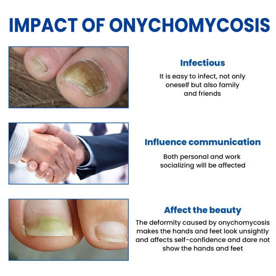 60Pcs/Box Nail Repair Patches Nail Repair Treatment Restores Damaged Nails and Appearance