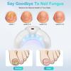 Fungal Nail Device for Rapid Repair of Nails Fungal Onychomycosis Repair of Toenails Removal of Nail Fungi and Treatment