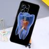 Чехол Зуб Стоматолога Для Xiaomi Redmi 12 9C 10C 12C 13C Для Redmi Note 12 Pro 11 8 9 10 Pro 9S 10S 11S 12S