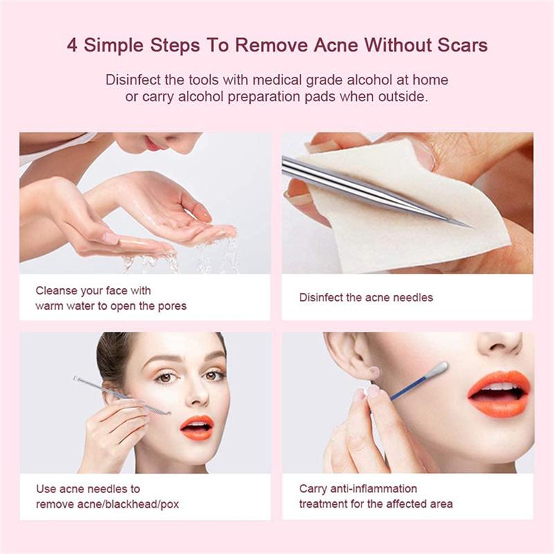 DUcare 4 шт. иглы для удаления угрей от прыщей из нержавеющей стали, экстрактор прыщей, очиститель комедонов, набор инструментов для ухода за кожей