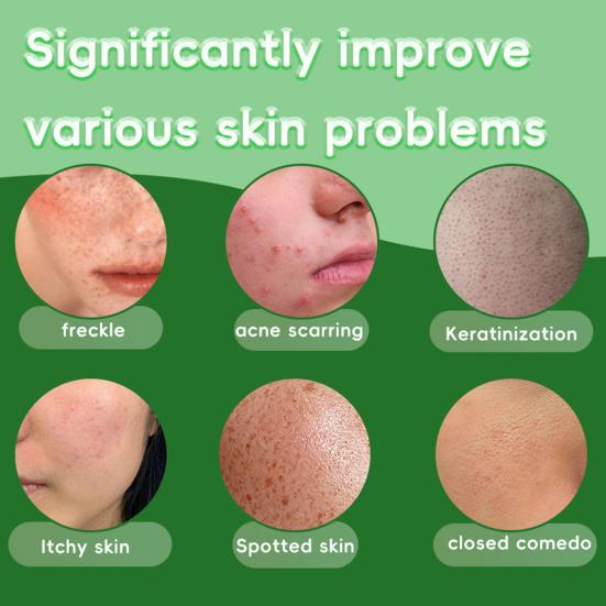 Lemon Turmeric Soap Shea Butter Moisturizing Soap for Face Body Moisturizing Brightening Oily Skin Balancing Soap for All Skin Type