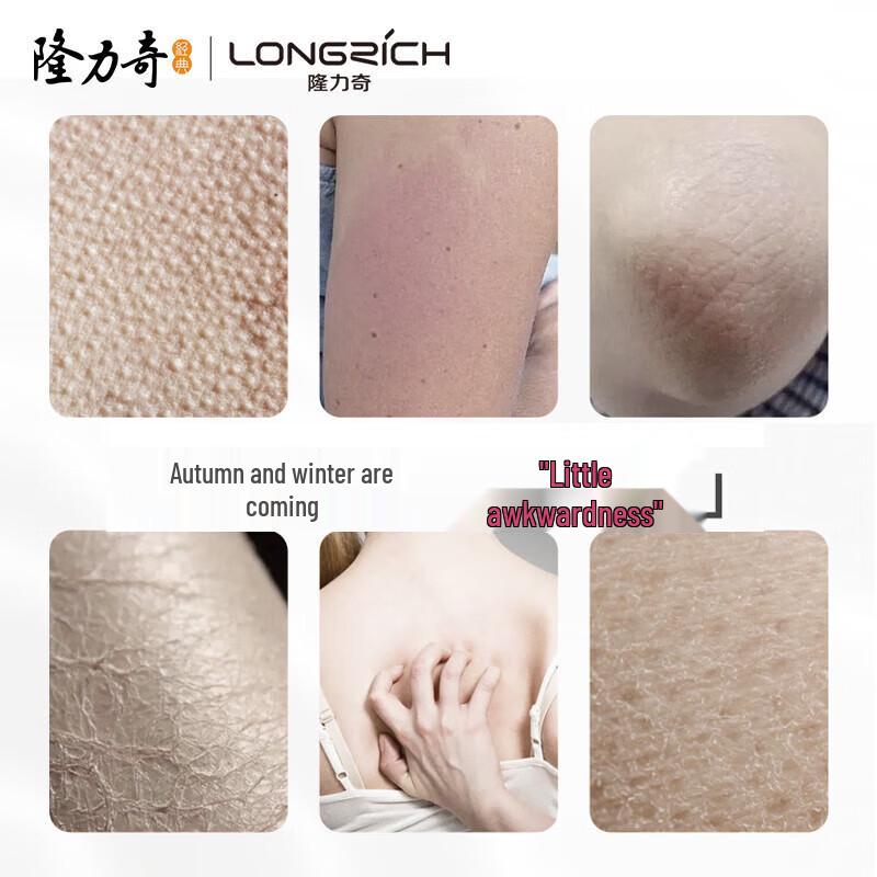 Longliqi Vitamin E Lotion