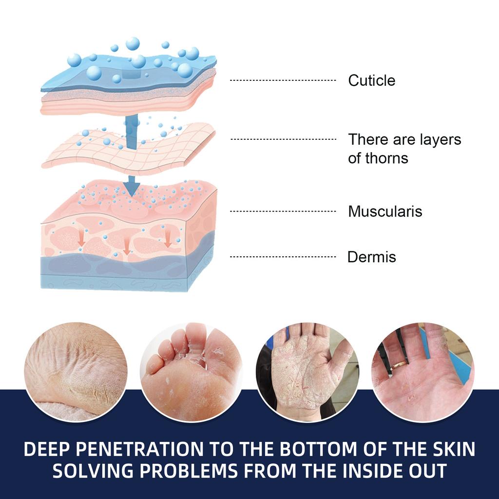 Увлажняющий крем для рук и ног для потрескавшейся и огрубевшей кожи, восстанавливающий и питательный крем для рук