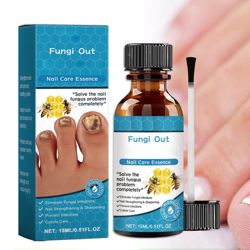 Onychomycosis Care Toenail Soft Nail Thickening Nail Granulation Nail Liquid15ml