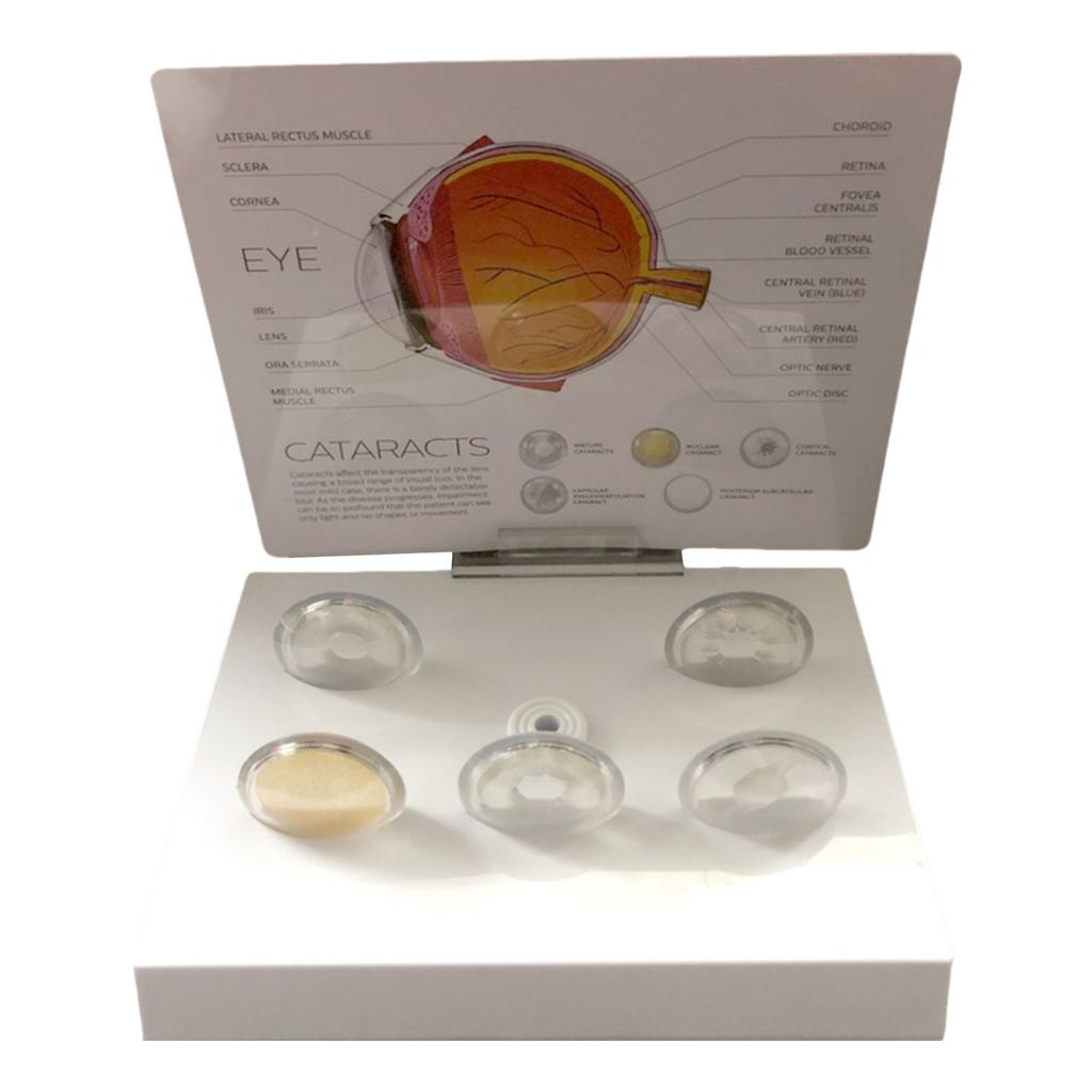 Модель анатомии человеческого глаза Анатомическая патологическая модель глазного яблока Обучающее пособие Реалистичная патологическая модель анатомии глазного яблока