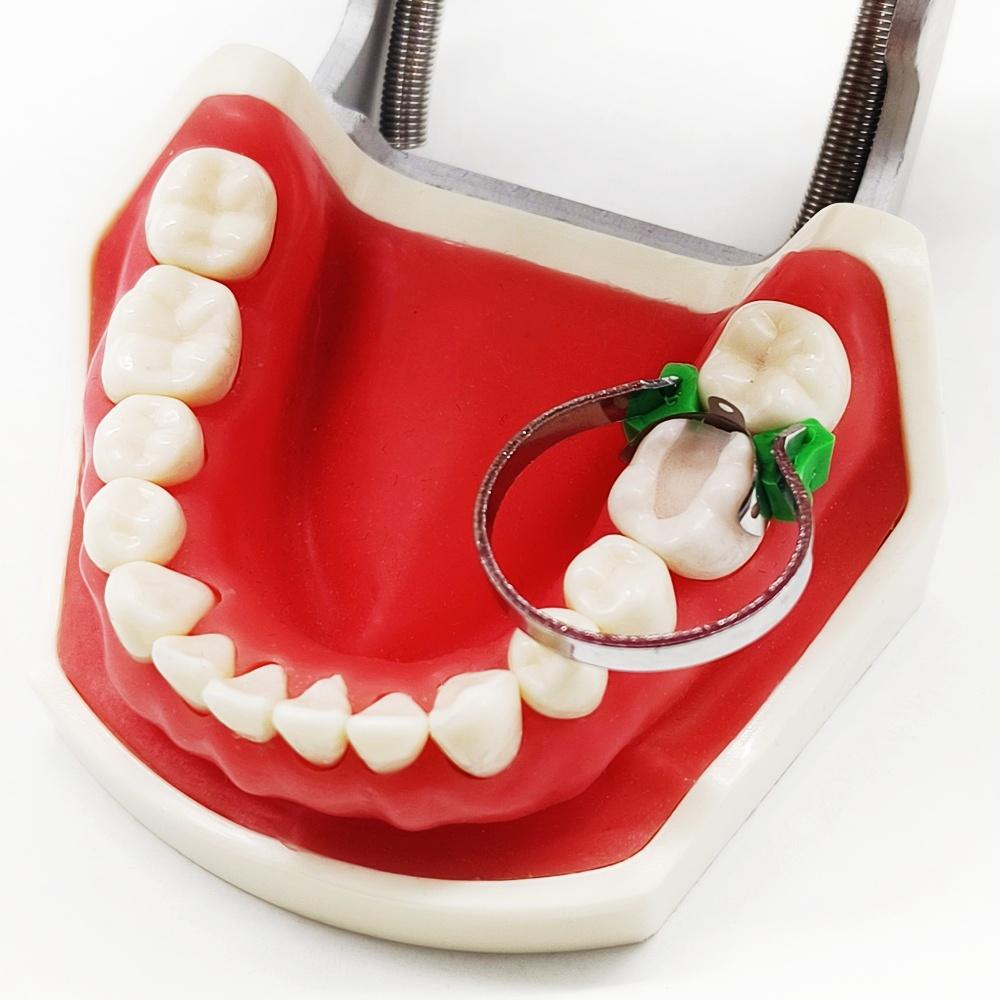 1 коробка, новые стоматологические 80 шт./упак., секционные контурные металлические матрицы, матрицы M4, набор матричных клиньев с дополнительными клиньями, резиновые клинья, полимерные зажимы