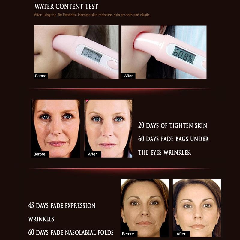 Сыворотка против старения и удаления веснушек ARTISCARE, отбеливающая и эссенция для лица против морщин, 3 шт./лот