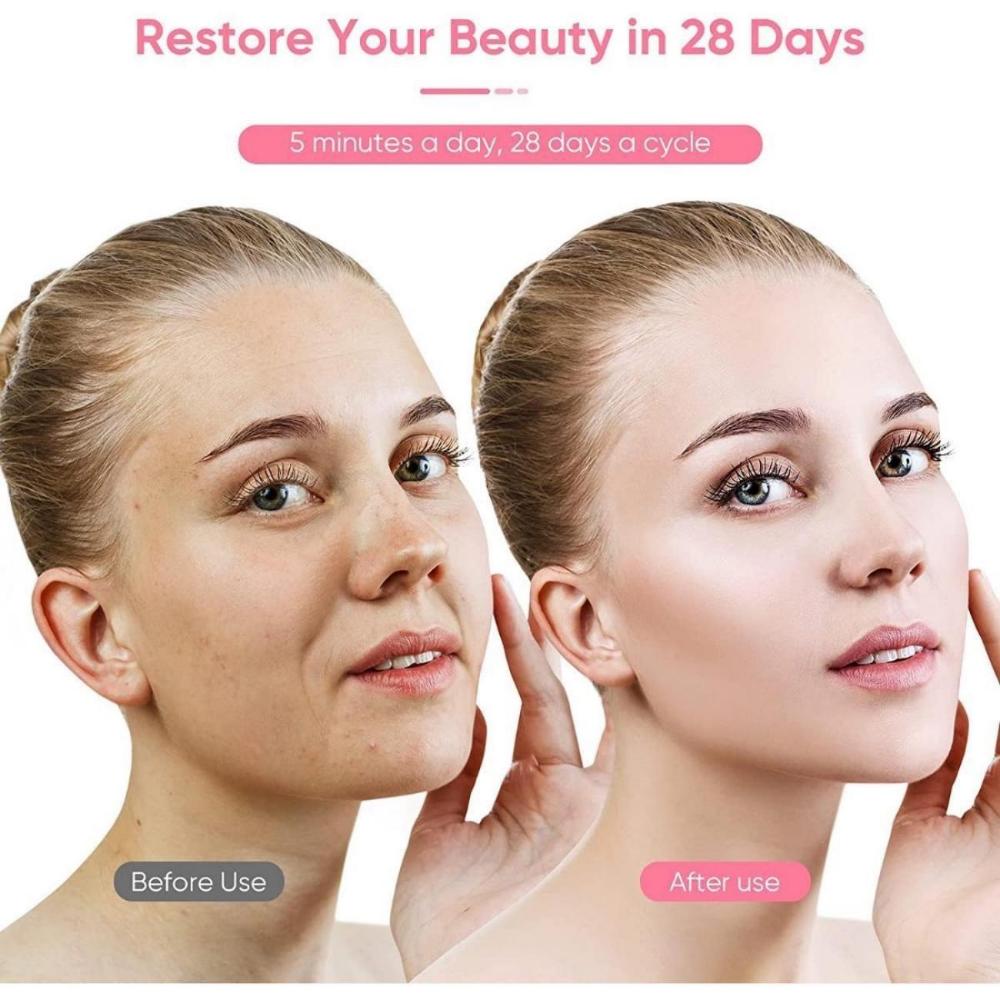 Micro Current Facial Device USB Rechargeable Facial Massager/facial Shaping Tool/facial Lifting Device