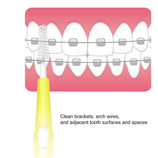 Yousheng Зубная щетка для межзубных промежутков Безопасная Эргономичная Телескопическая Здравоохранение Межзубная щетка