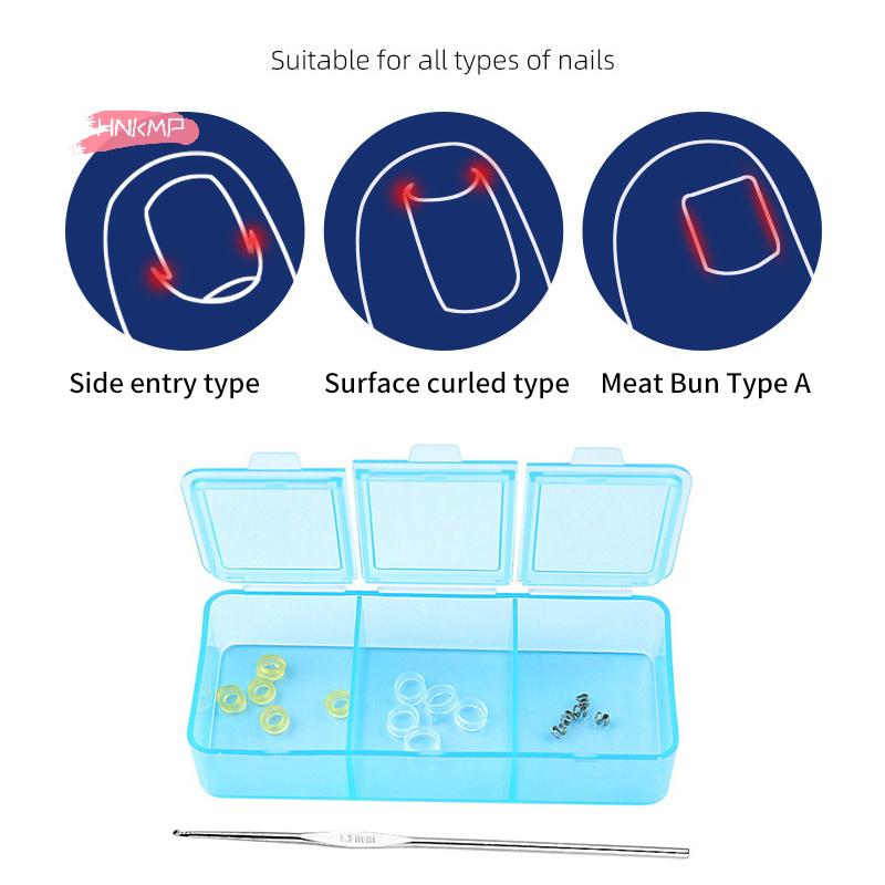 Профессиональный корректор вросшего ногтя педикюр лечение ногтей на ногах пластыри для коррекции стопы инструмент для ухода за вросшим ногтем