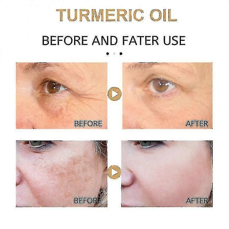 2x 30ml Turmeric Oil Pure Natural Pleasant Moisturizing Anti-aging Serum Lighten