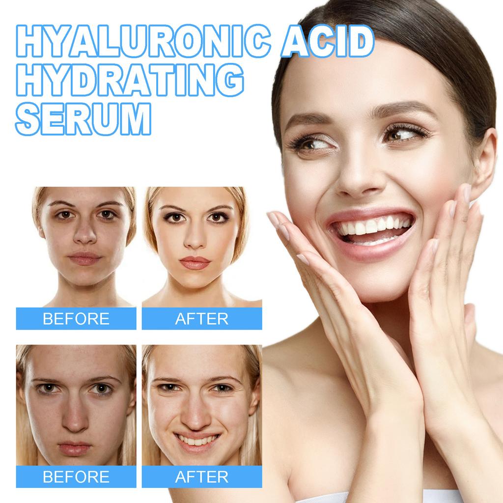 Гиалуроновая кислота Увлажняющая сыворотка для ухода за кожей лица против морщин, осветляющая и укрепляющая эссенция для кожи