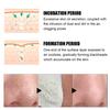 Safe Healthy Multifunctional Universal Mild Clean Acne Gentle Nose Plants Pores Strips