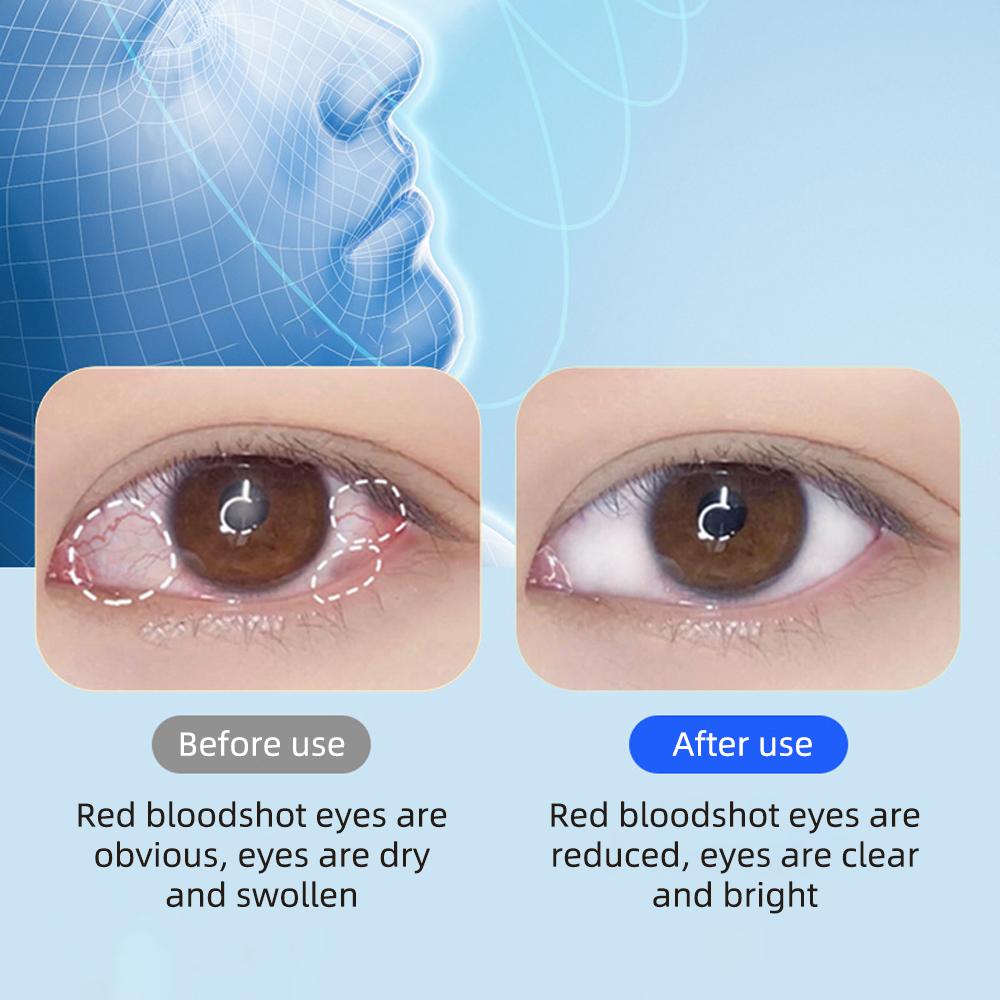 Холодный и горячий компресс и распыляемое устройство для увлажнения глаз