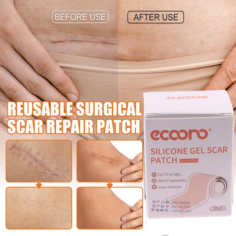 5 м/рулон Силиконовый пластырь от рубцов Рулон ленты от рубцов Лист для удаления рубцов Самоклеящаяся лента Терапевтический пластырь Ожог Акне Хирургический шрам Уход за кожей
