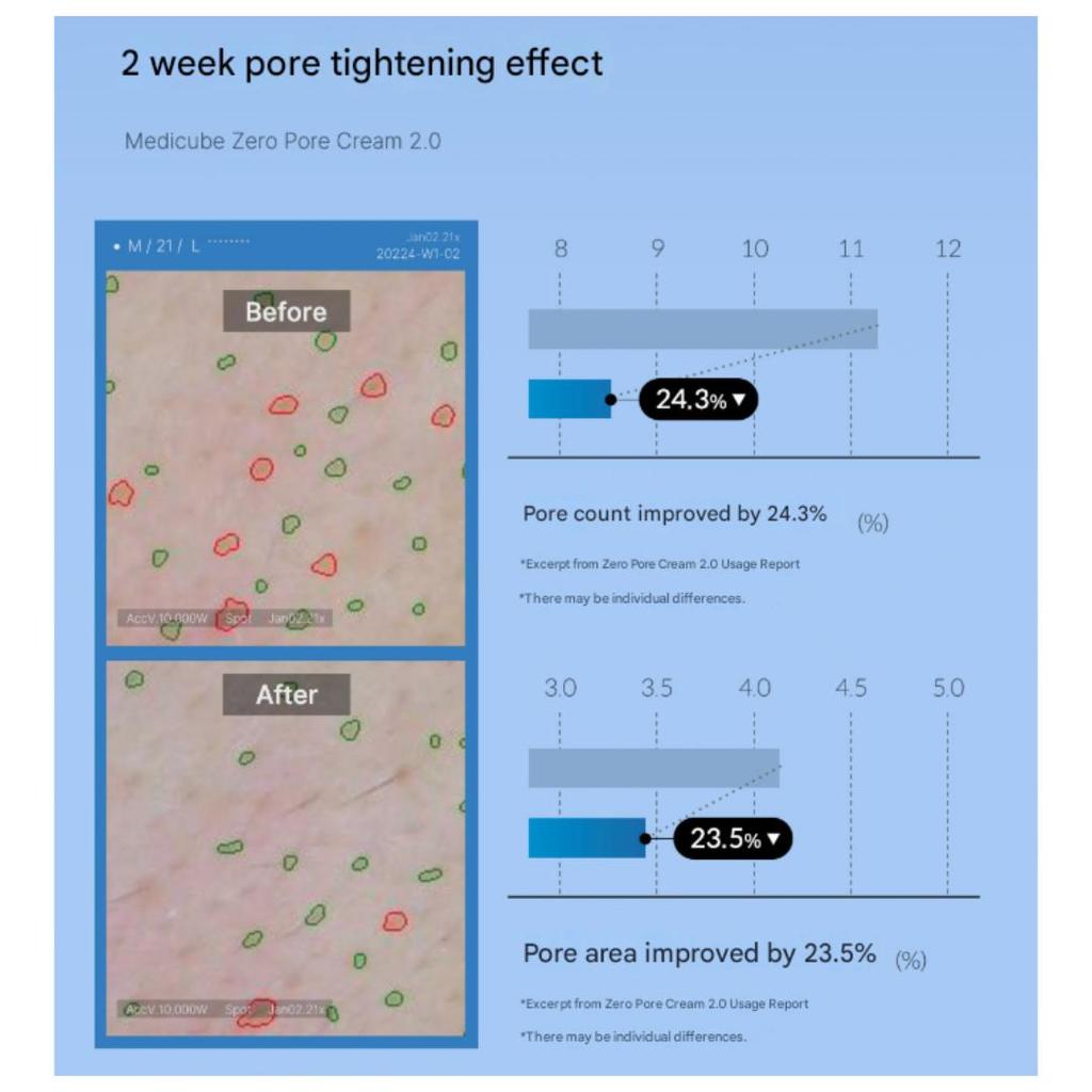 Medicube Zero Pore Cream 2.0 (50 Ml) (3 Options)