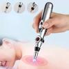 Electronic Acupuncture Pen Acupuncture Point Pen Acupuncture Point Pen Meridian Energy Meridian Pen Massage Pen Acupuncture Acup