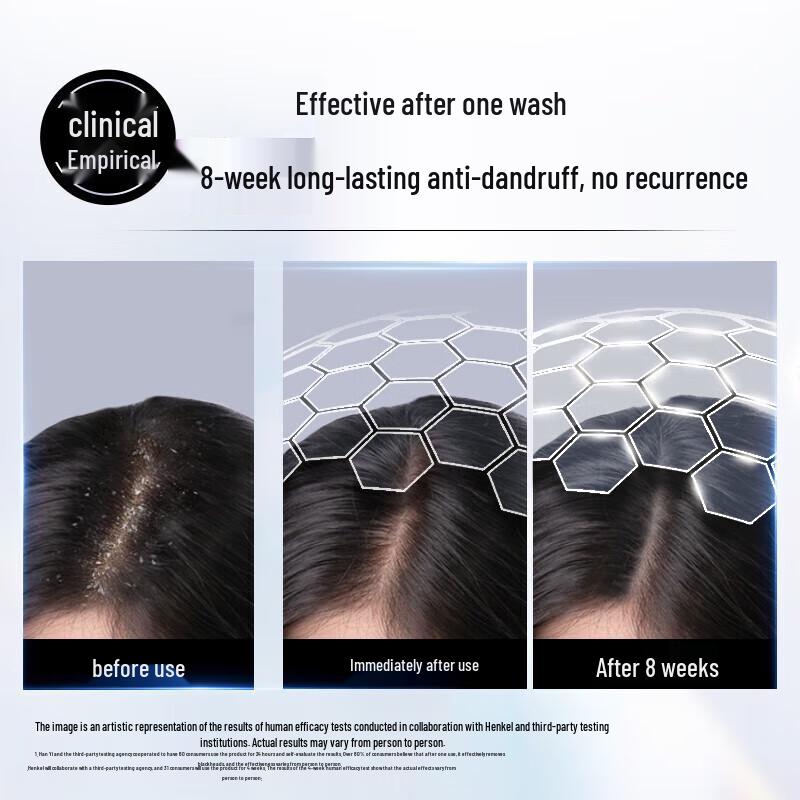 Schwarzkopf Anti-Dandruff Conditioning Shampoo