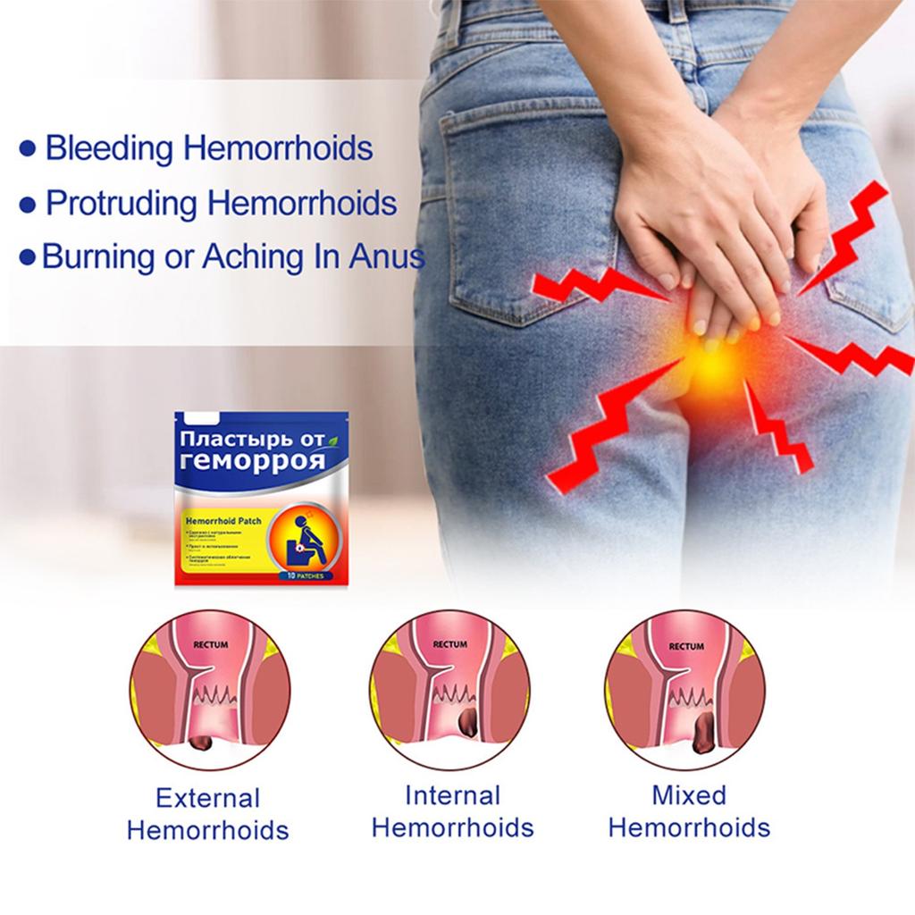 Успокаивающий пластырь от геморроя, быстродействующий крем от геморроя для быстрого снятия боли, отека, дискомфорта и зуда 10 таблеток (Пакетик)