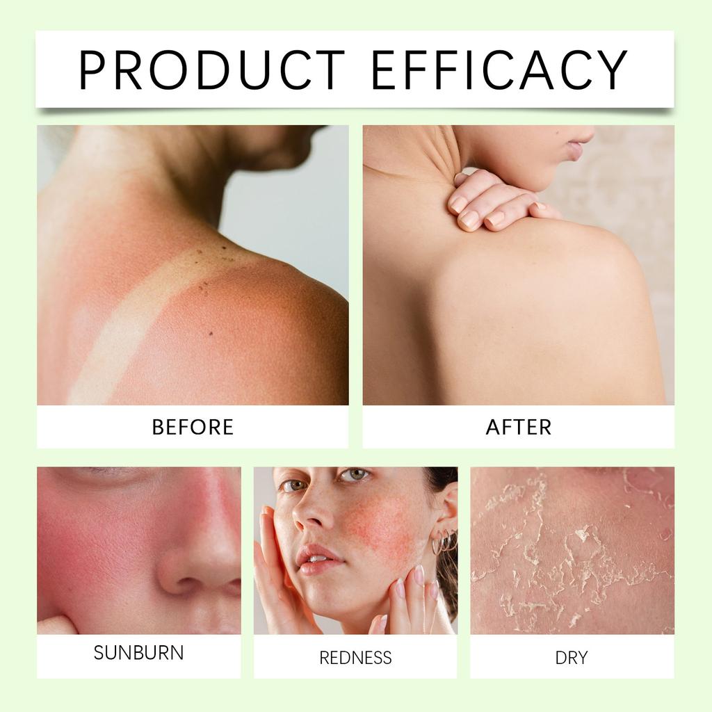 Успокаивающий гель с алоэ, увлажняет чувствительные мышцы, снимает покраснение и успокаивает, мягкий увлажняющий гель для ухода, 1 шт, 100 мл