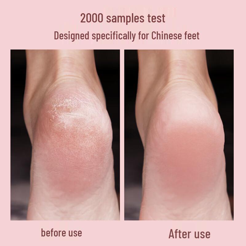 MKS Electric Foot Grinder