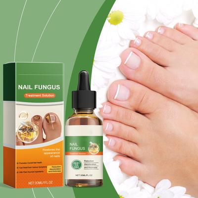 Лосьон для ухода за ногтями Увлажняющий лосьон для рук, ног и ногтей для ежедневного ухода за ногтями 30 мл